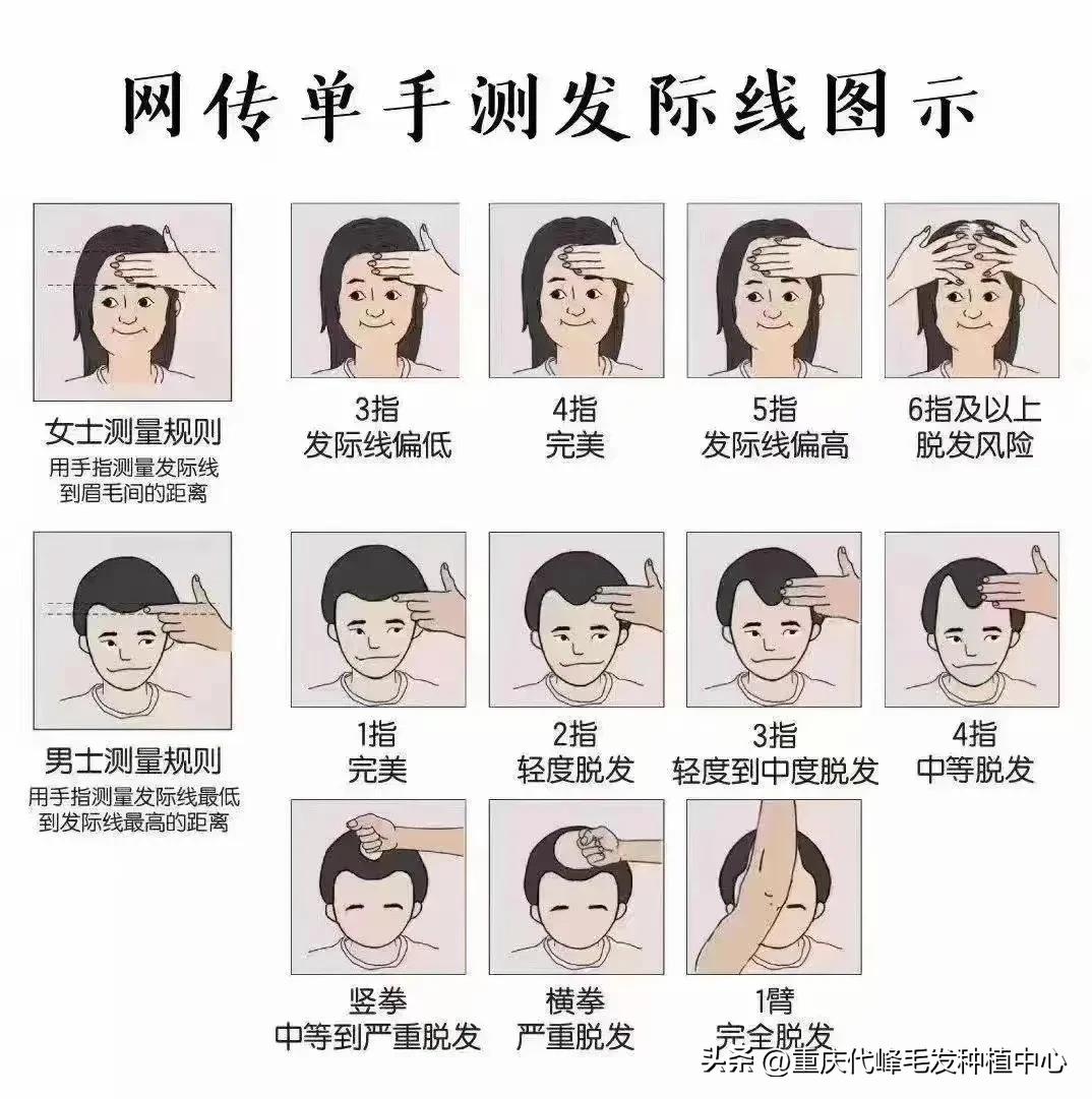 快速脱发的药物,如何抑制脱发视频