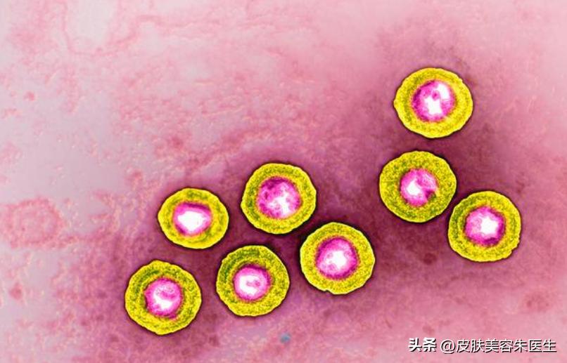 怎么区分尖锐性湿疣和生殖器疱疹,分辨尖锐性湿疣