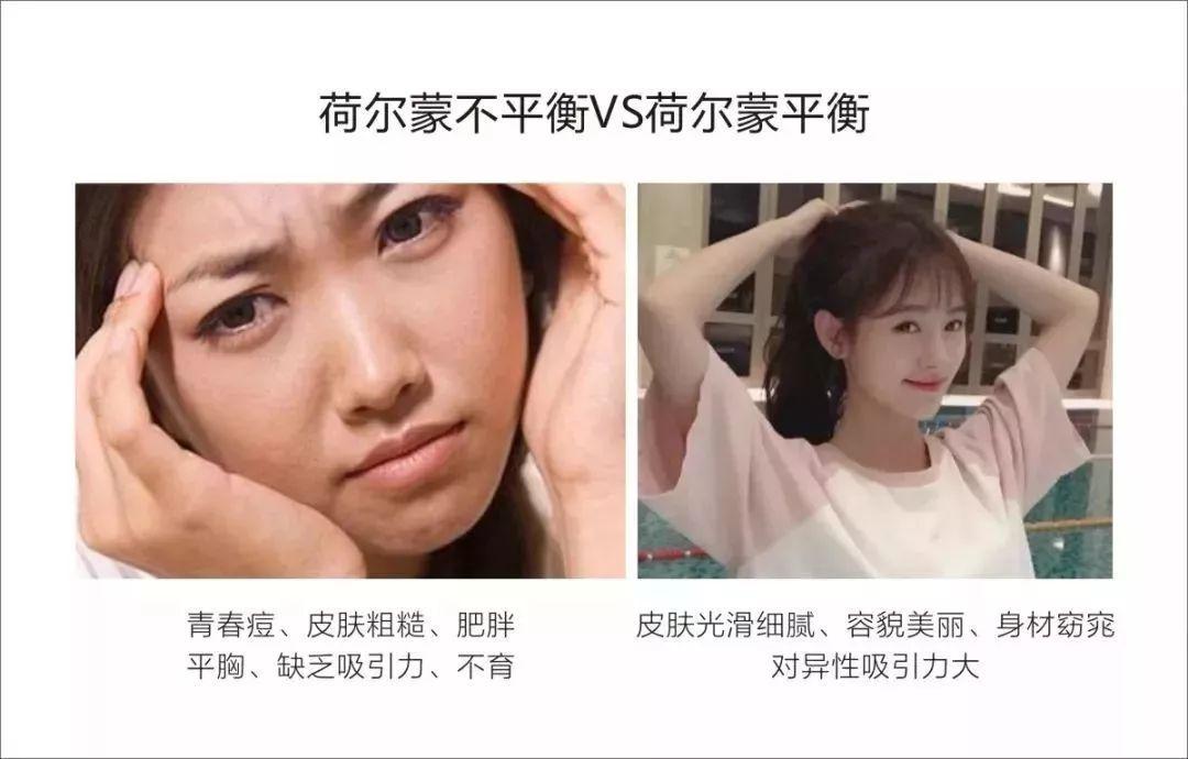 荷尔蒙旺盛的女性一般有什么特征,荷尔蒙旺盛的5个特征