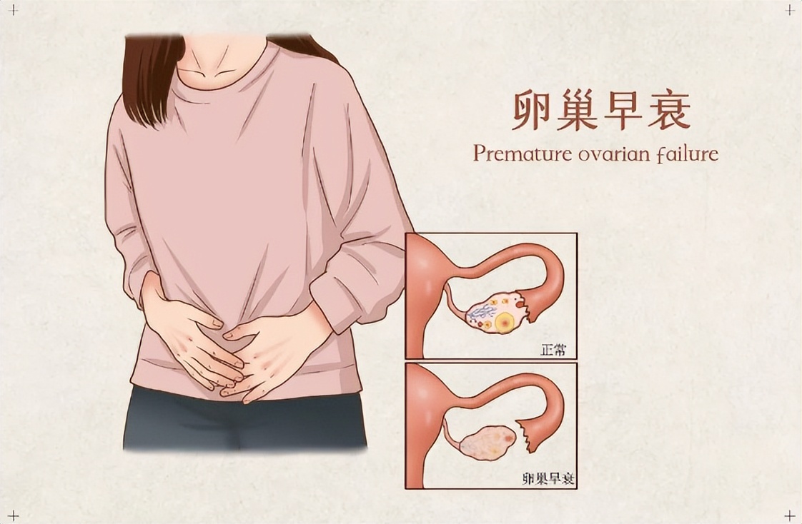 卵巢早衰是内分泌失调引起的吗,卵巢早衰和内分泌失调一样概念吗