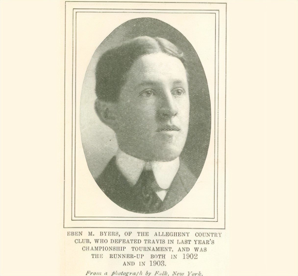 被镭辐射后的女工,核辐射后维持生命的工人