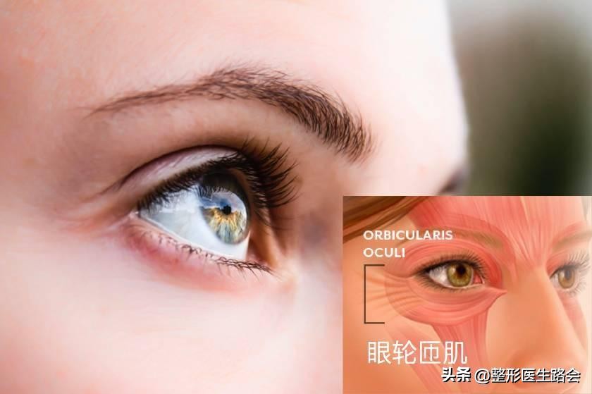 眼袋类型分不清,眼袋卧蚕傻傻分不清