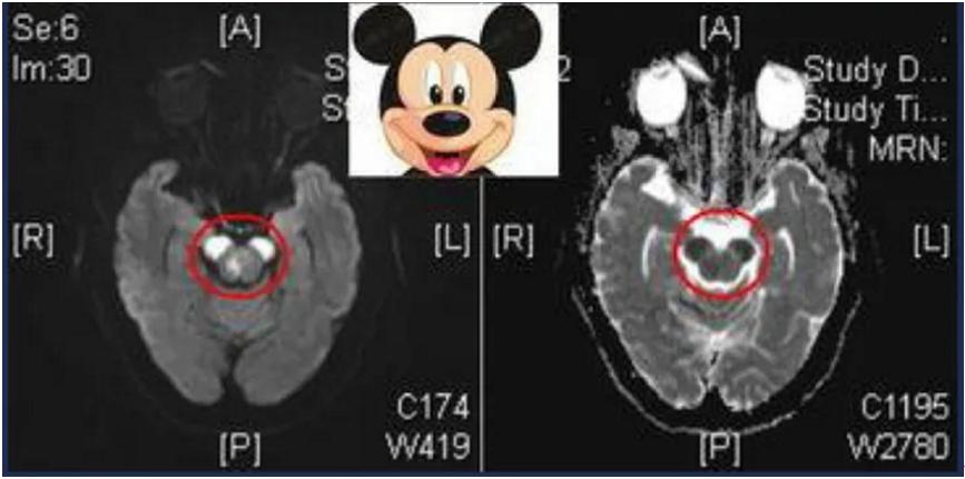 颅脑解剖图简单,颅脑相关解剖生理知识