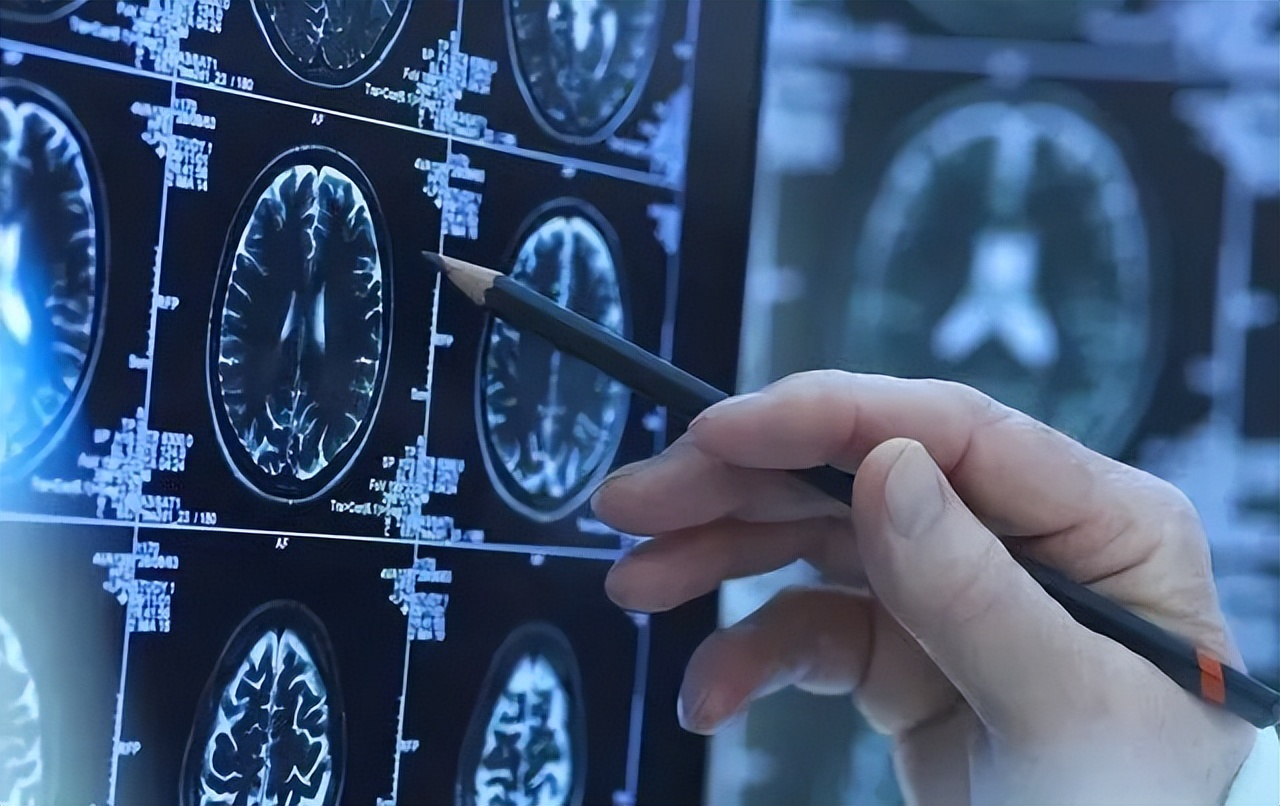 帕金森病中医治疗的最好方法,帕金森病中医名家医论医案