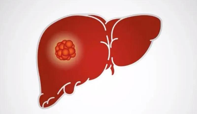 癌症早期有4个信号,身体发出这些信号可能是癌症预警