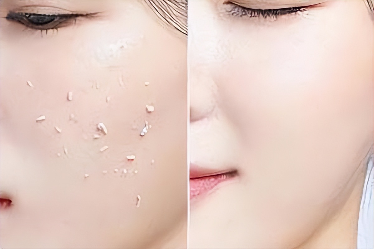 上海文峰美容美发:毛孔粗大很绝望?别慌,还能抢救