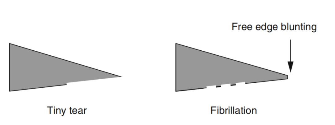 磁共振诊断半月板撕裂但没有症状,半月板桶柄状撕裂磁共振影像表现