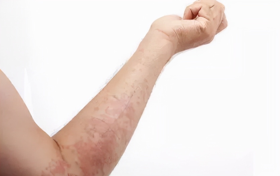 敏感肌肤护肤品最好用的精华,修护敏感肌肤护肤品成分