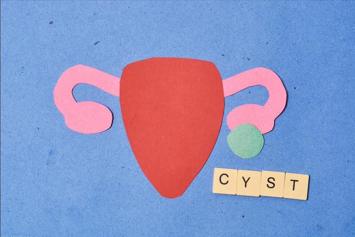 靠近卵巢有个囊肿,卵巢囊肿是不是被气出来的