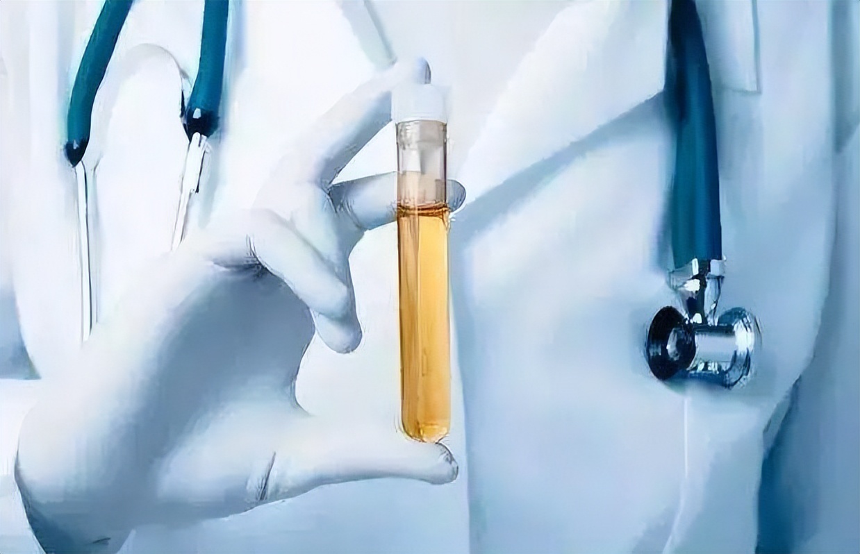 癌确认需要穿刺活检吗,穿刺活检就是为了检测有没有癌变