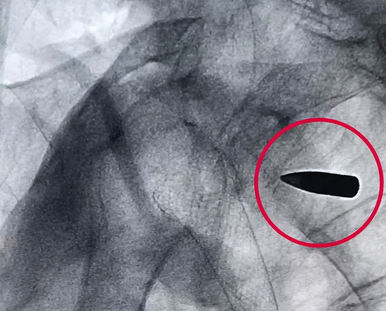 发小卡片被异地警察抓获,民警开车抓小卡片