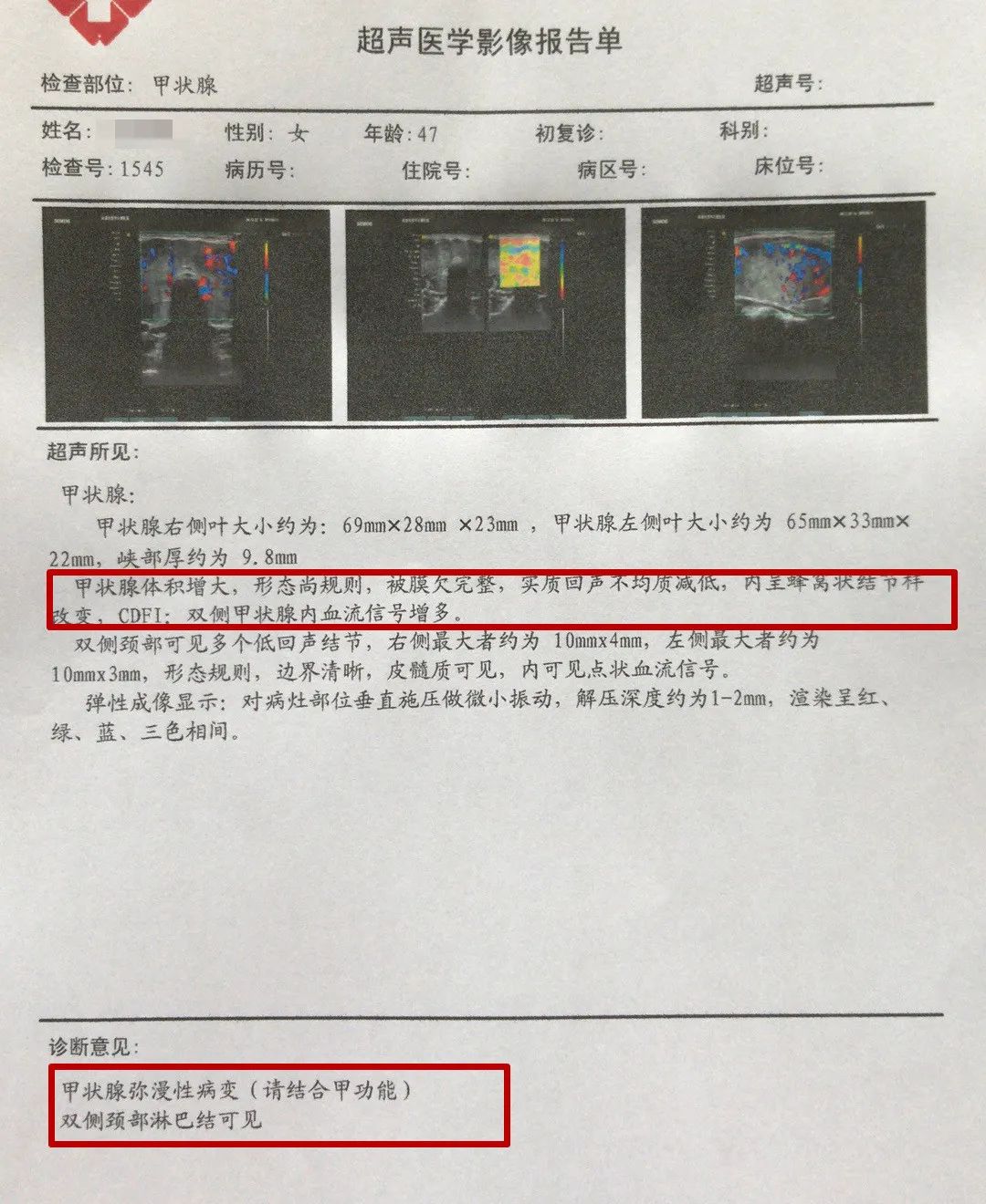 16岁女孩桥本氏甲状腺炎治疗,14岁女孩桥本甲状腺炎能治愈吗