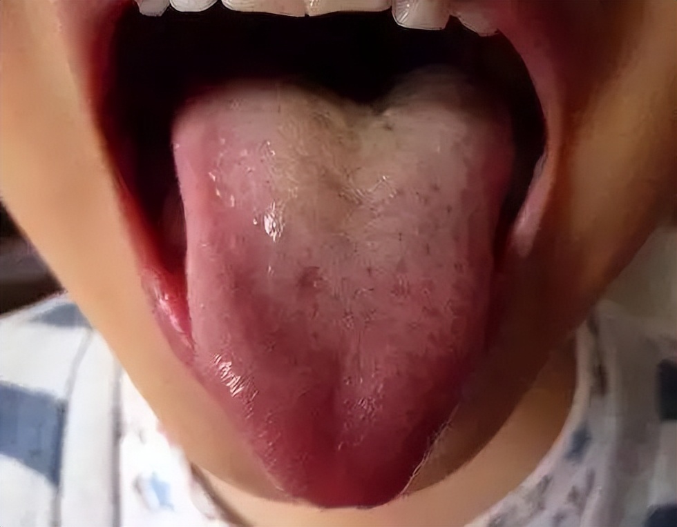 秋冬换季感冒怎么办,秋转冬容易感冒是什么感冒