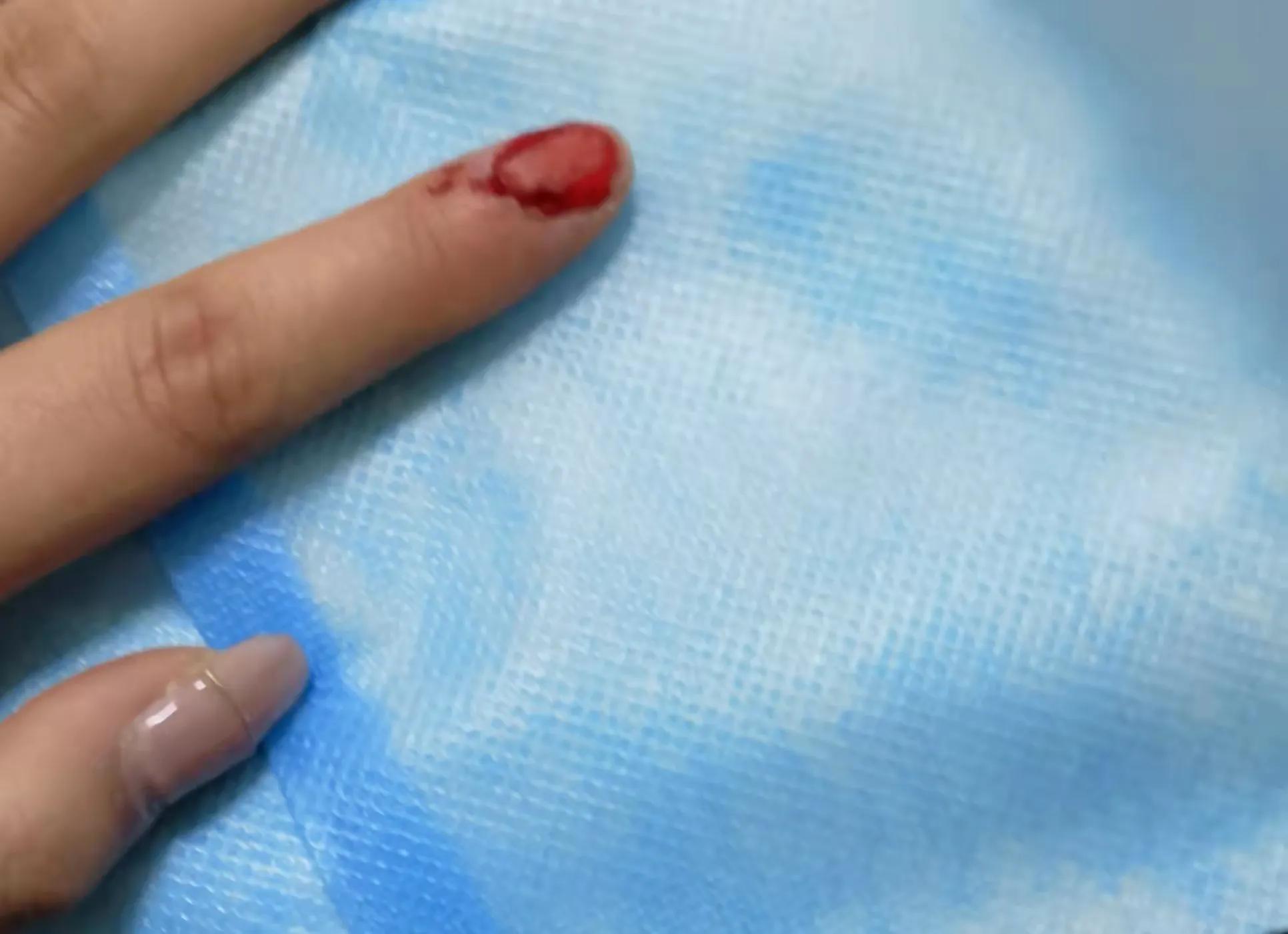 荆棘生长过程,荆棘成长过程