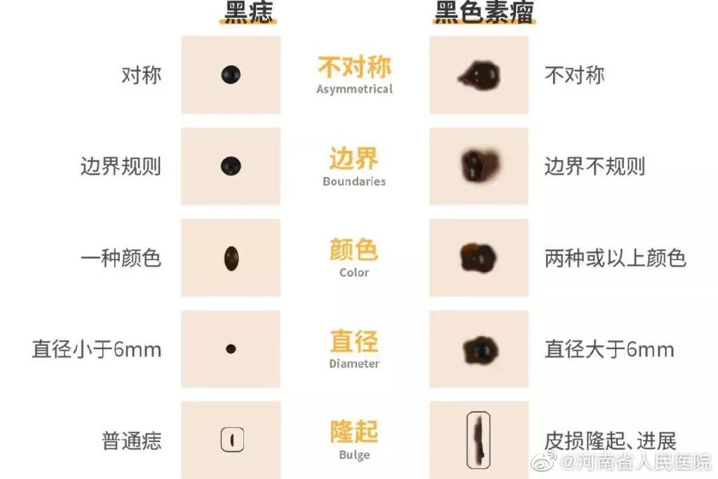 健康生活|痣也会恶化成癌!“好声音”亚军因此去世,年仅37岁