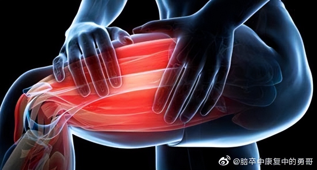 什么是中风偏瘫膝过伸,什么是偏瘫主动康复训练