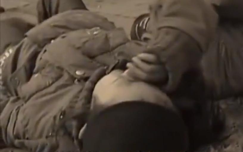 故事：大连39岁姑娘患怪病，皮肤坚硬宛如石膏，专家结论希望渺茫