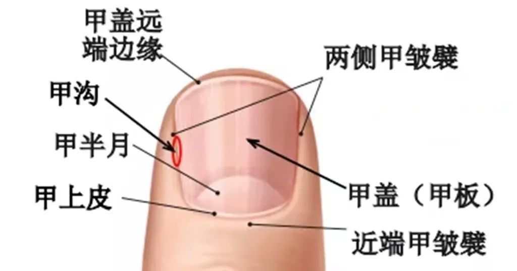 脚趾甲总是往肉里长怎么办,脚趾里长指甲怎么办