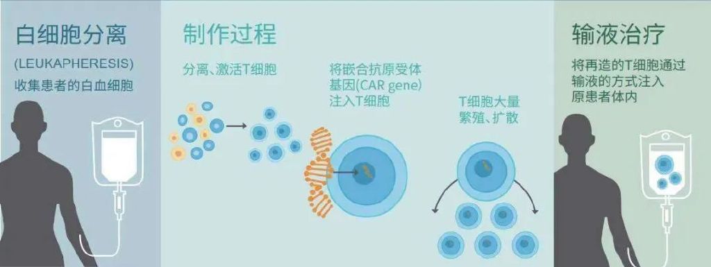 car-t治疗成功的白血病案例,童春容主任专访