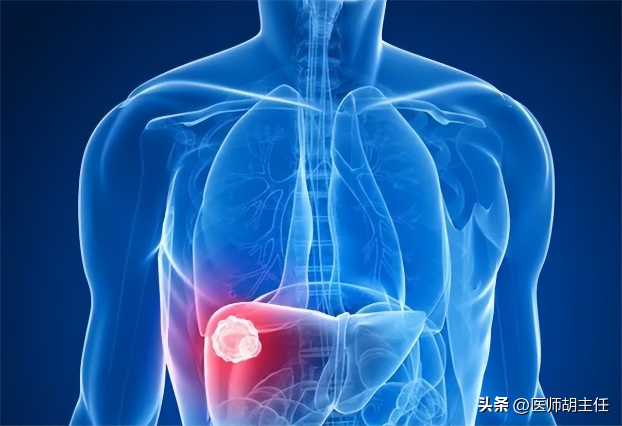 体检肝部囊肿最大2.8怎么办,体检发现肝囊肿肾囊肿