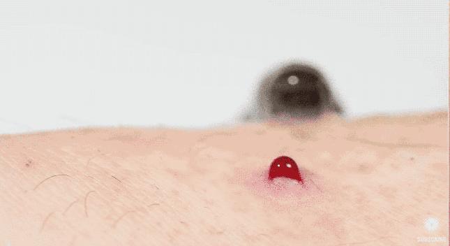 夏日带孩子户外活动当心这种虫,暑期带娃小心毒虫