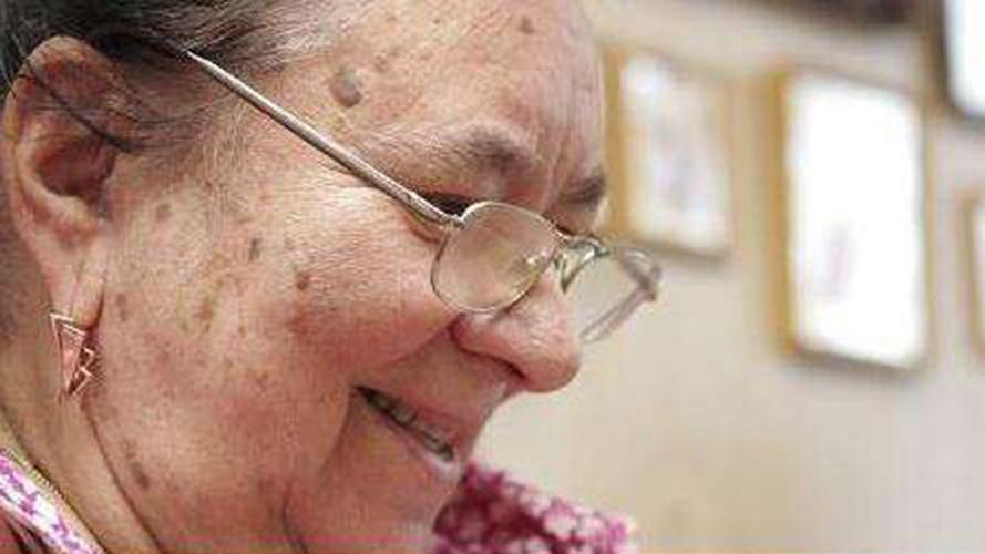 红霉素软膏可以去除老年斑吗,红霉素软膏能去除老年斑吗