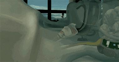 男孩打呼噜有什么好方法治疗吗,17岁的男孩打呼噜怎么回事