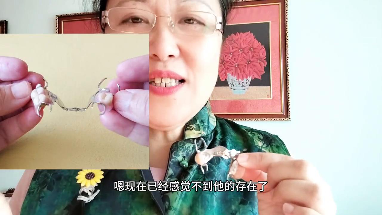 纯钛活动义齿价格,活动义齿取下演示