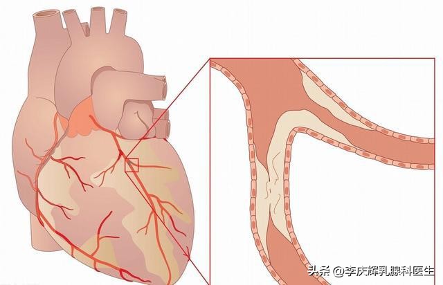 乳房疼痛是怎么回事乳腺增生,乳腺增生会出现乳房疼痛的症状