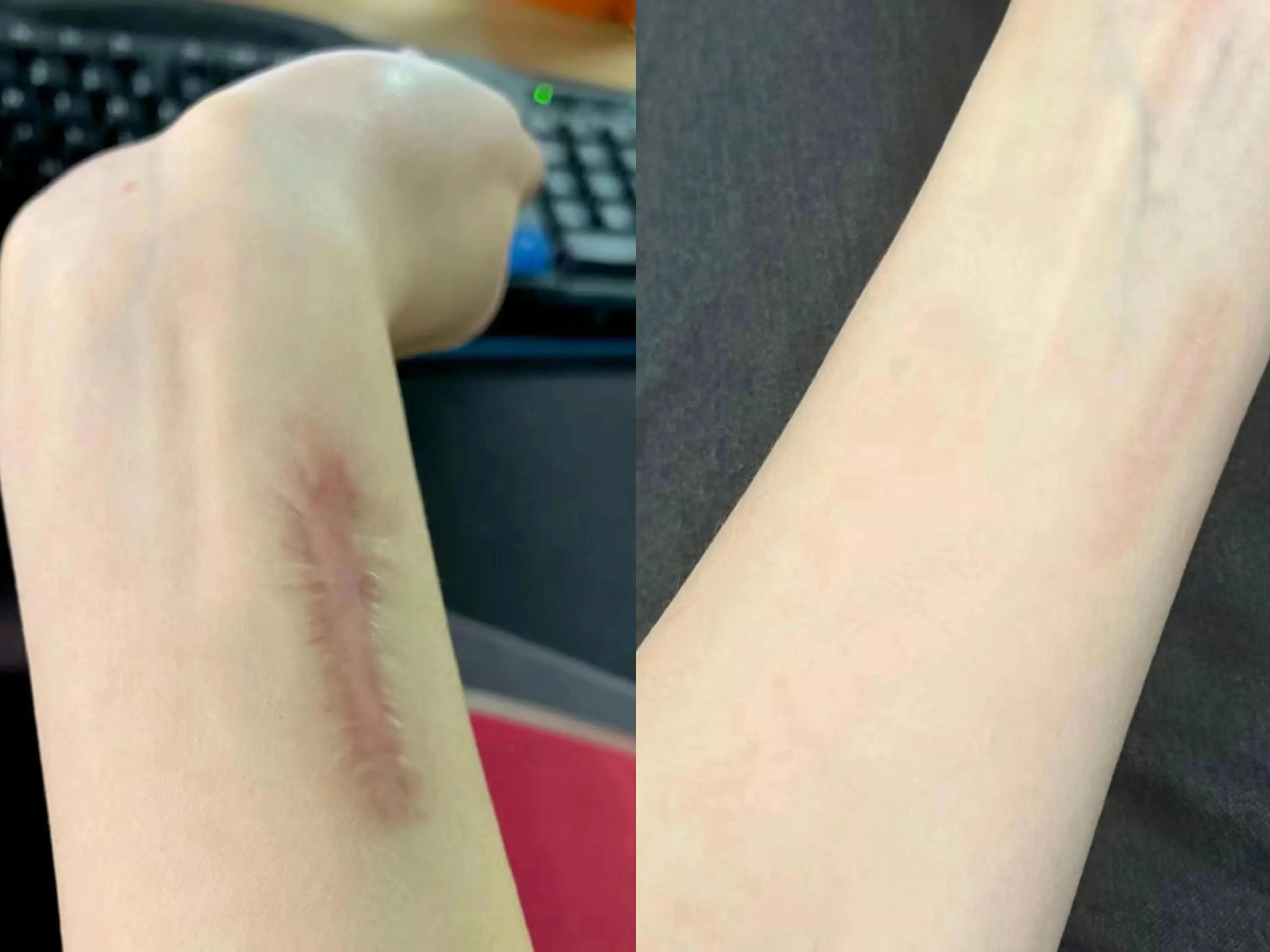 国货护肤界扛把子祛疤产品,国货祛疤产品排行榜10强