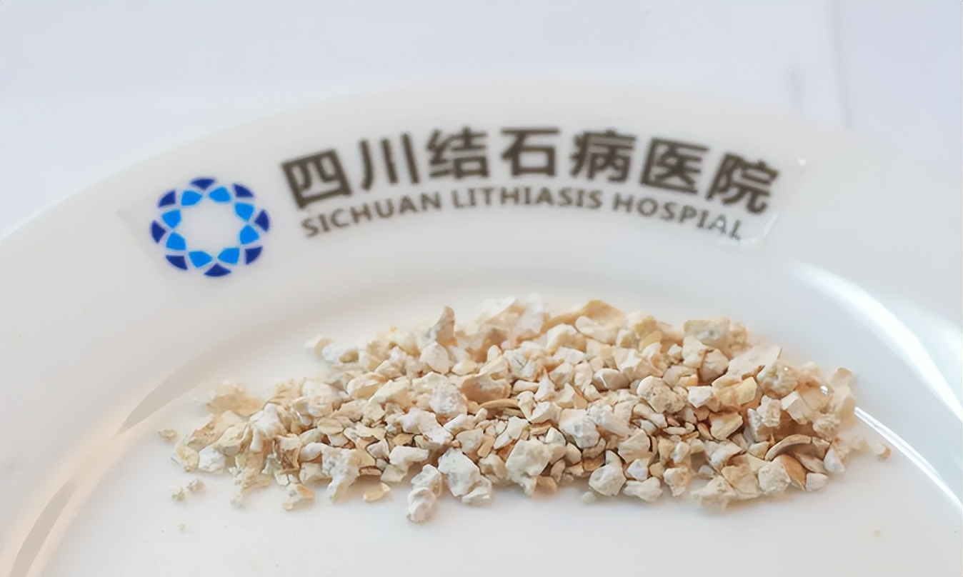 检查有肾结石没有症状应注意什么,肾结石没什么症状怎么办