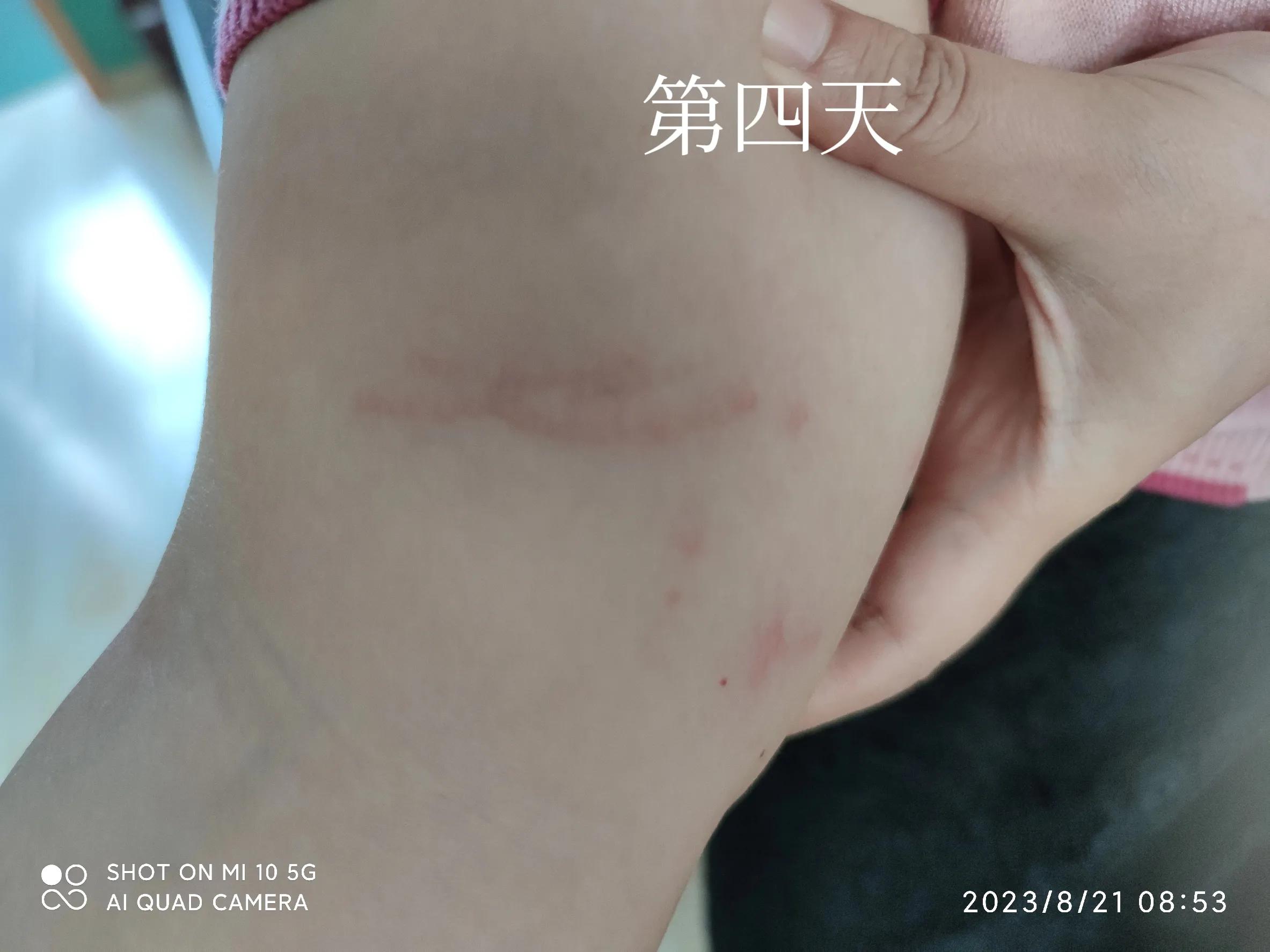 中医说疱疹怎么得的,中医让人糊里糊涂活着