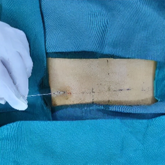 腰痛两年了一直治不好怎么办,反复腰疼怎么回事