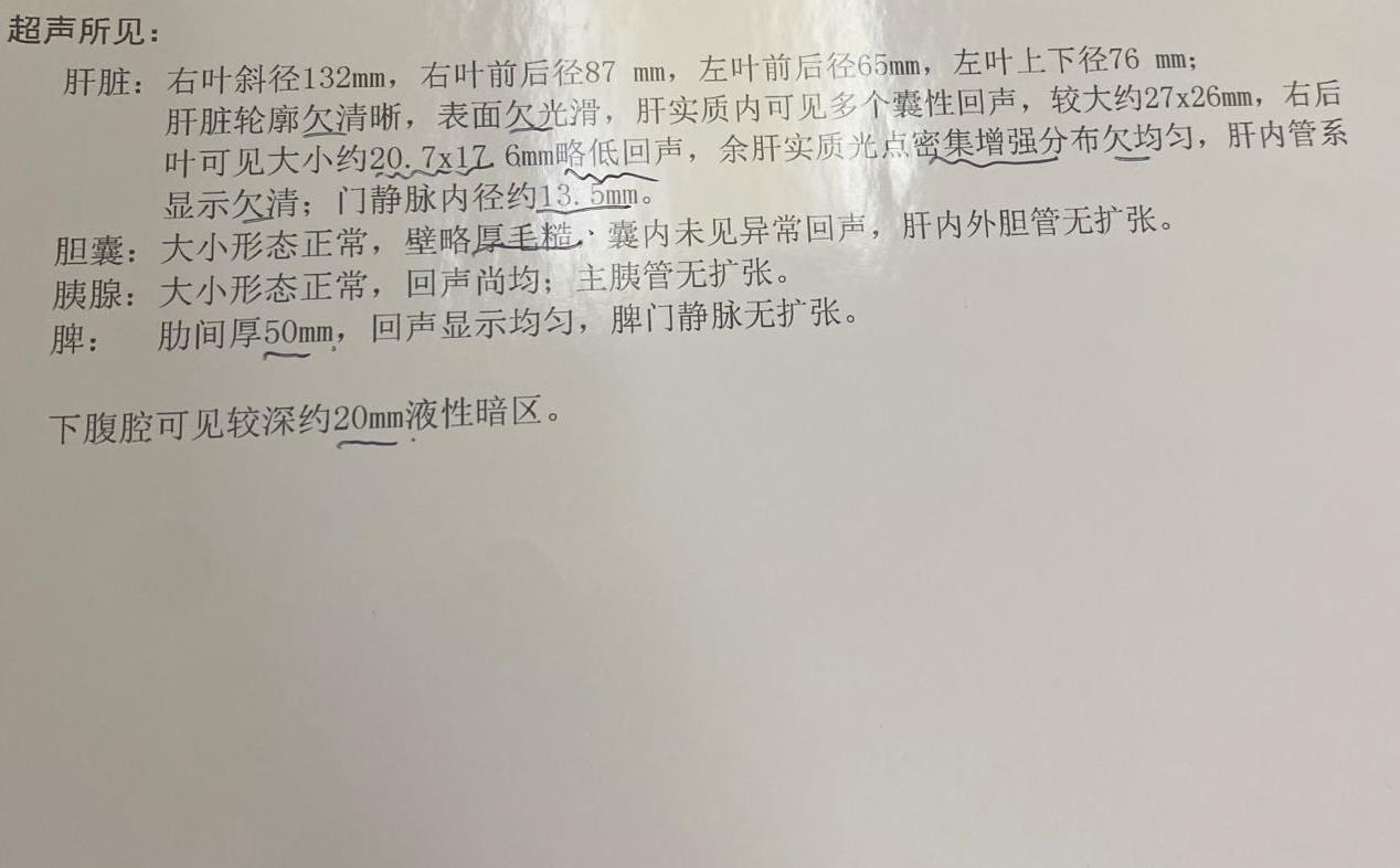 肝腹水治疗要谨慎，一味消水会把肾给消坏，最后人就没活头了