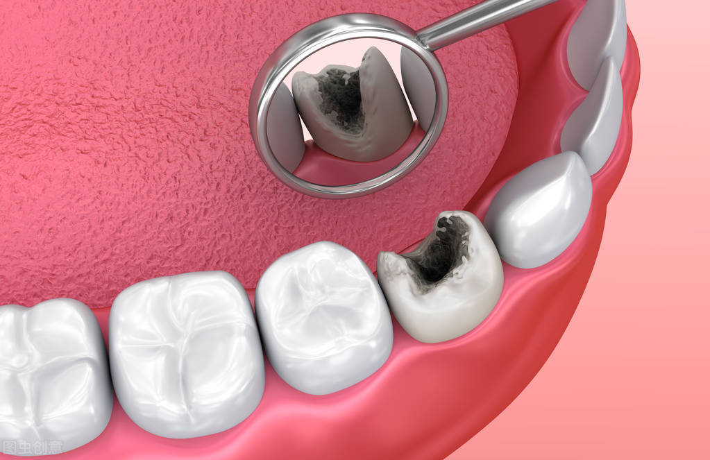 隔离期间如何熬过牙疼,隔离在家牙疼怎么办