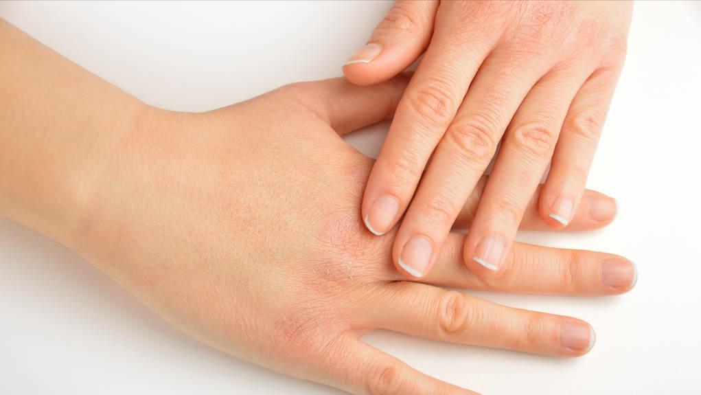 为什么头皮总长小疙瘩用什么药,为啥头皮上起脓包