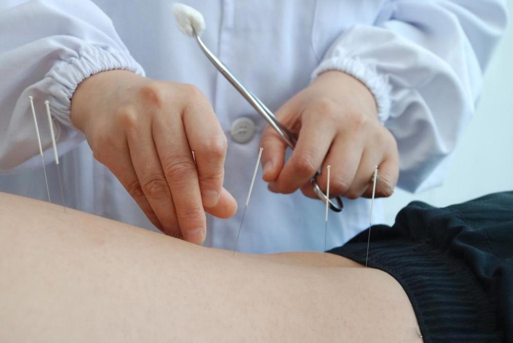 中医无痛治疗?芒针治疗中风后的寒热错杂型消化不良疗效相关研究