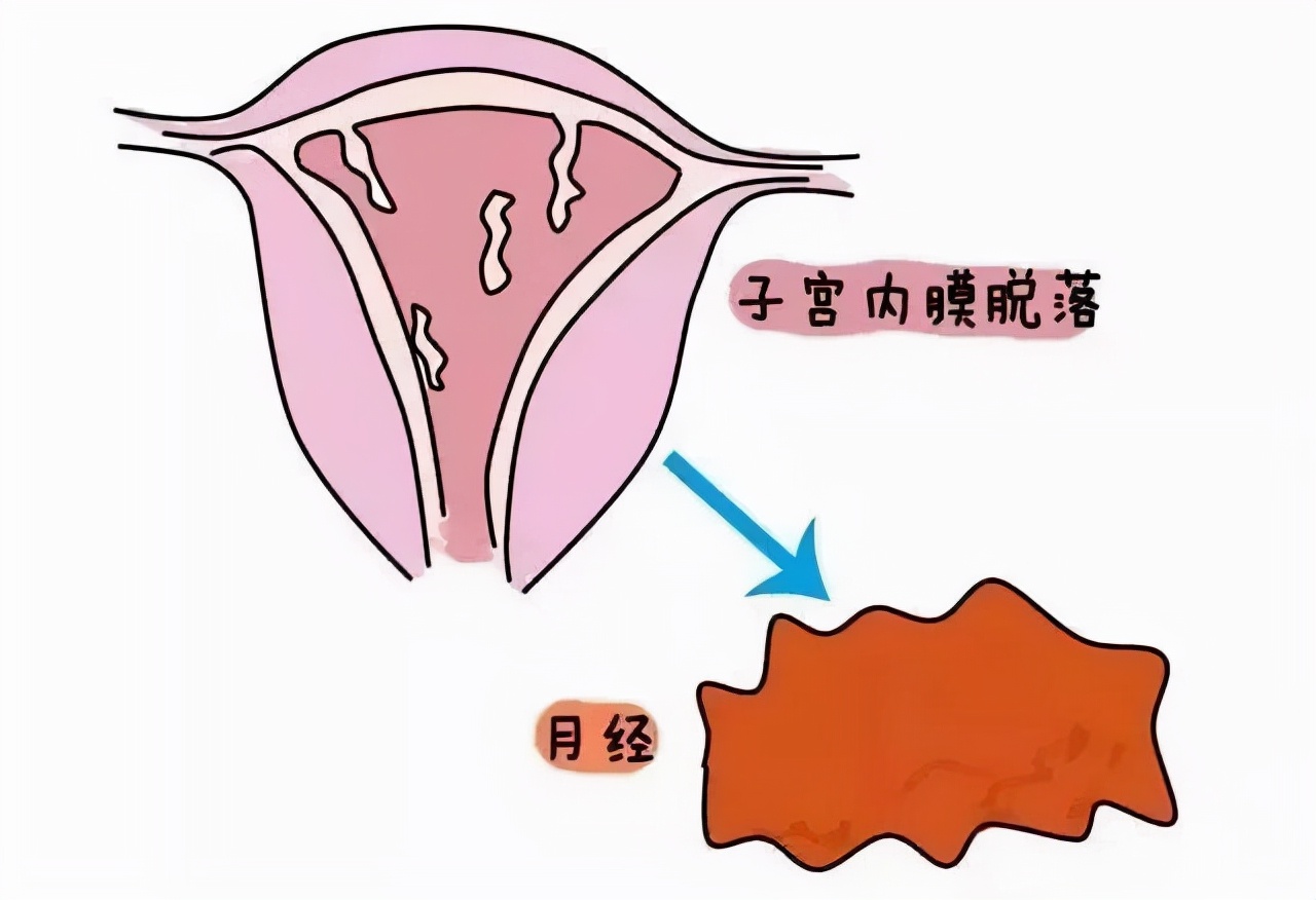 解析：黄体酮催经3大危害，看完后，你还敢用吗？