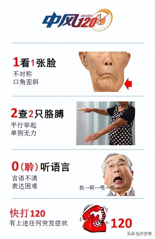 西安脑卒中,西安凤城医院预防保健科