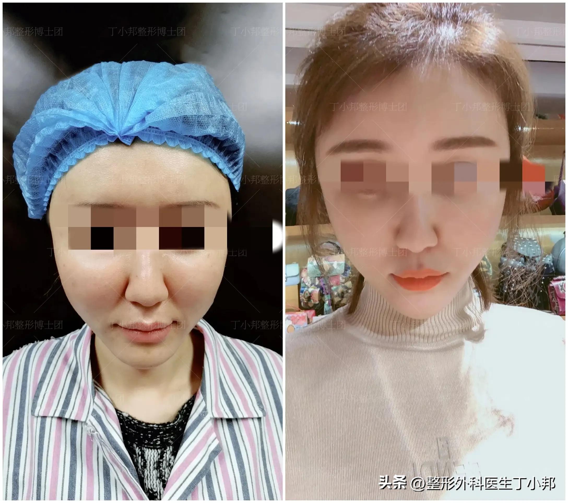 一个小姑娘毁容,一个女的毁容后才知道是救了自己