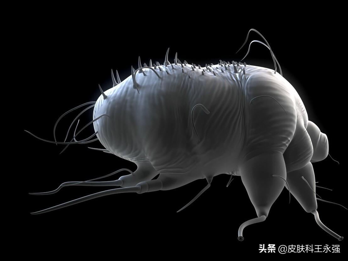 疥螨是怎样引起的,疥螨引起的症状