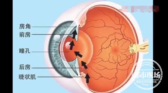 用筋膜枪按摩眼眶？！男子眼睛鼓得像气球，视力只剩四分之一
