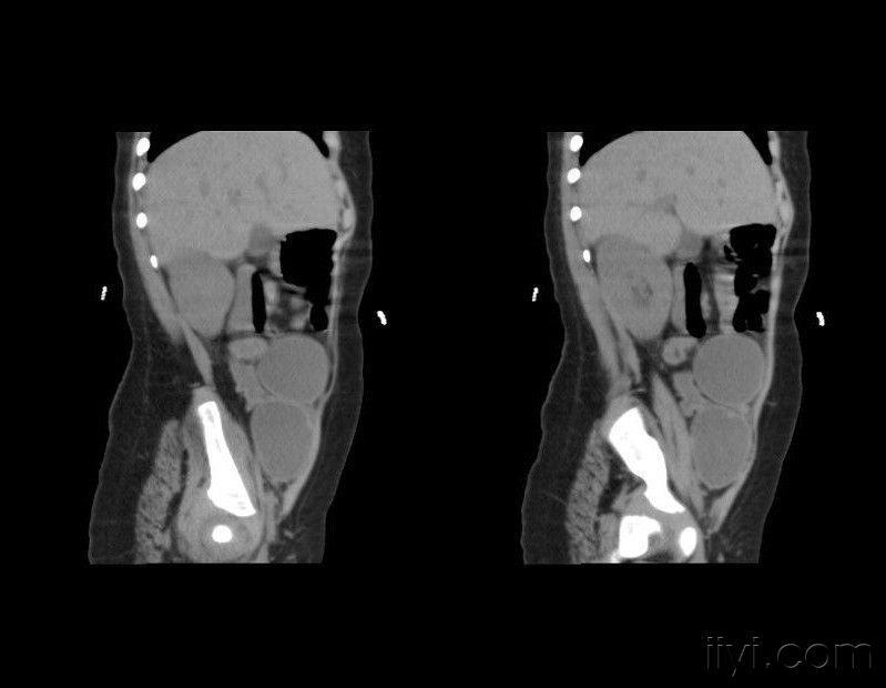 25岁已婚女子备孕一年怀不上,25岁已婚姑娘多次备孕未果