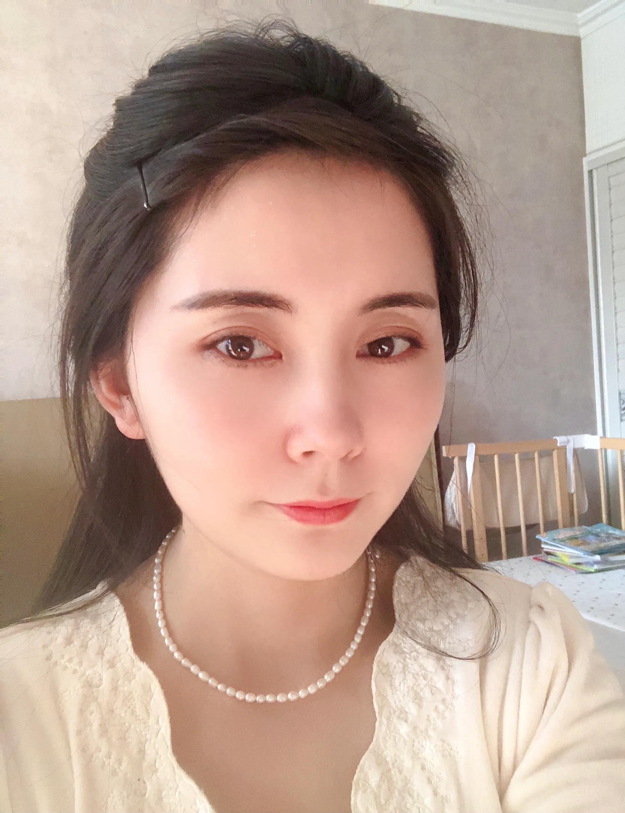 十年头皮屑终结之路