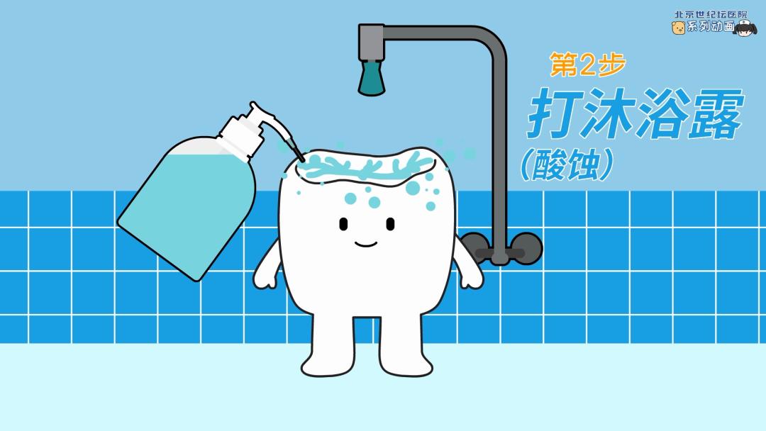 健康科普龋齿窝沟封闭,预防蛀牙科普视频