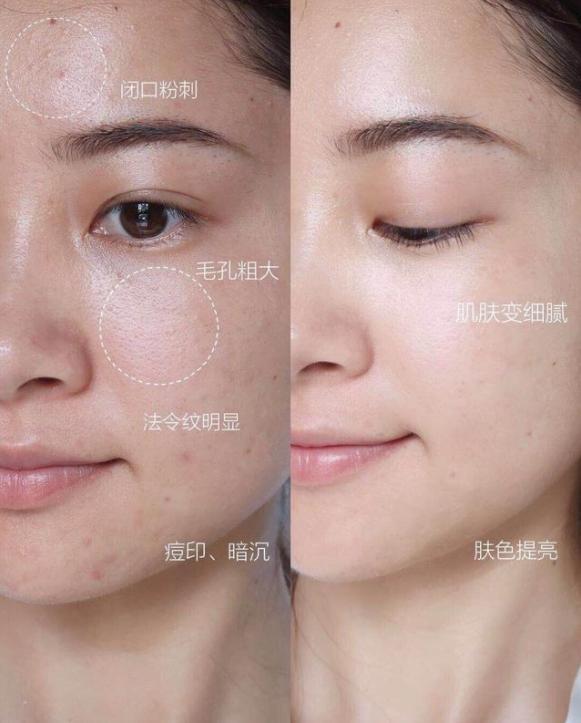 洗完脸后怎么拍爽肤水,洗脸后擦爽肤水几遍合适