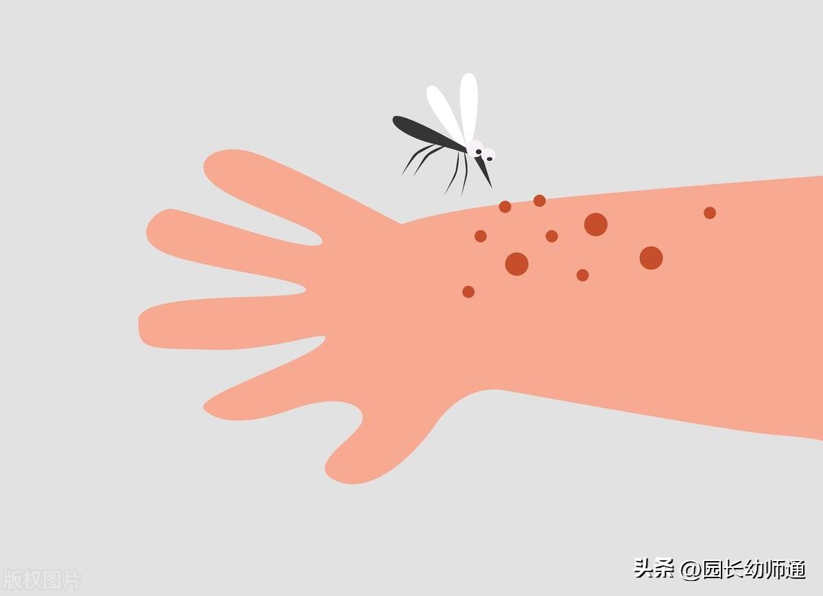 幼儿园防蚊策略,健康环保的7种驱蚊绝招