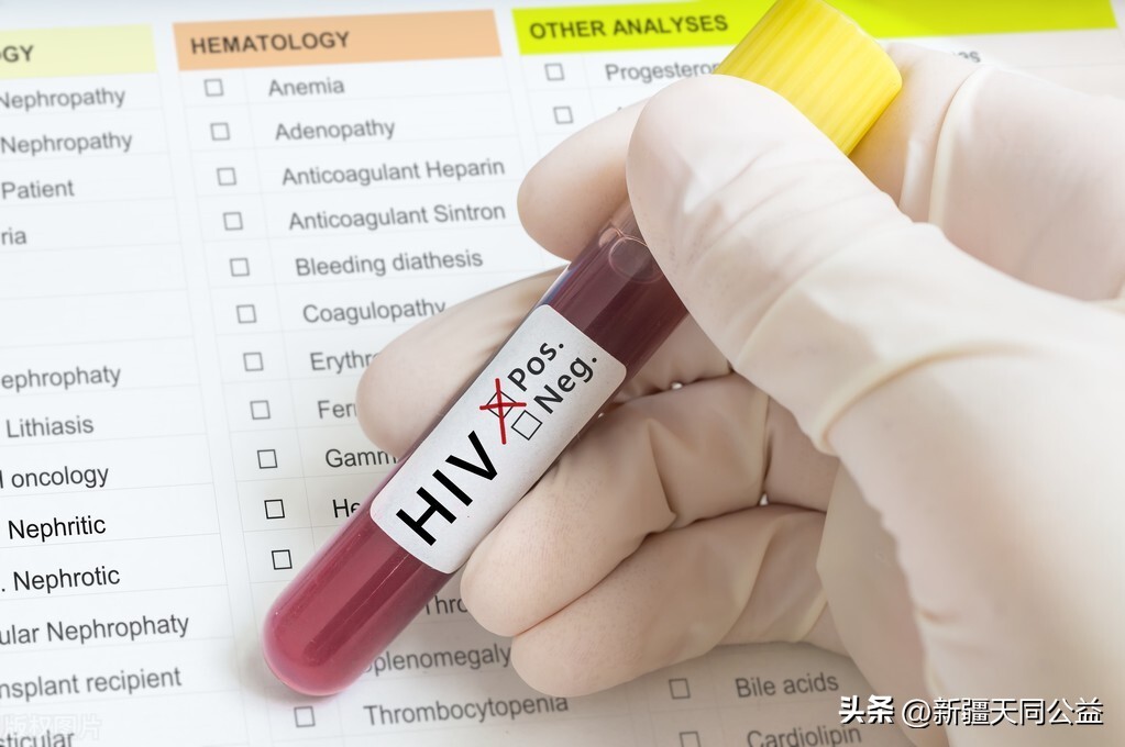 体检项目能查hiv吗,考公查hiv吗