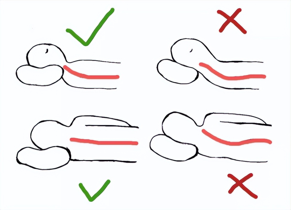 颈椎痛的不能动了怎么按摩,颈椎痛怎么办中医师教你一招