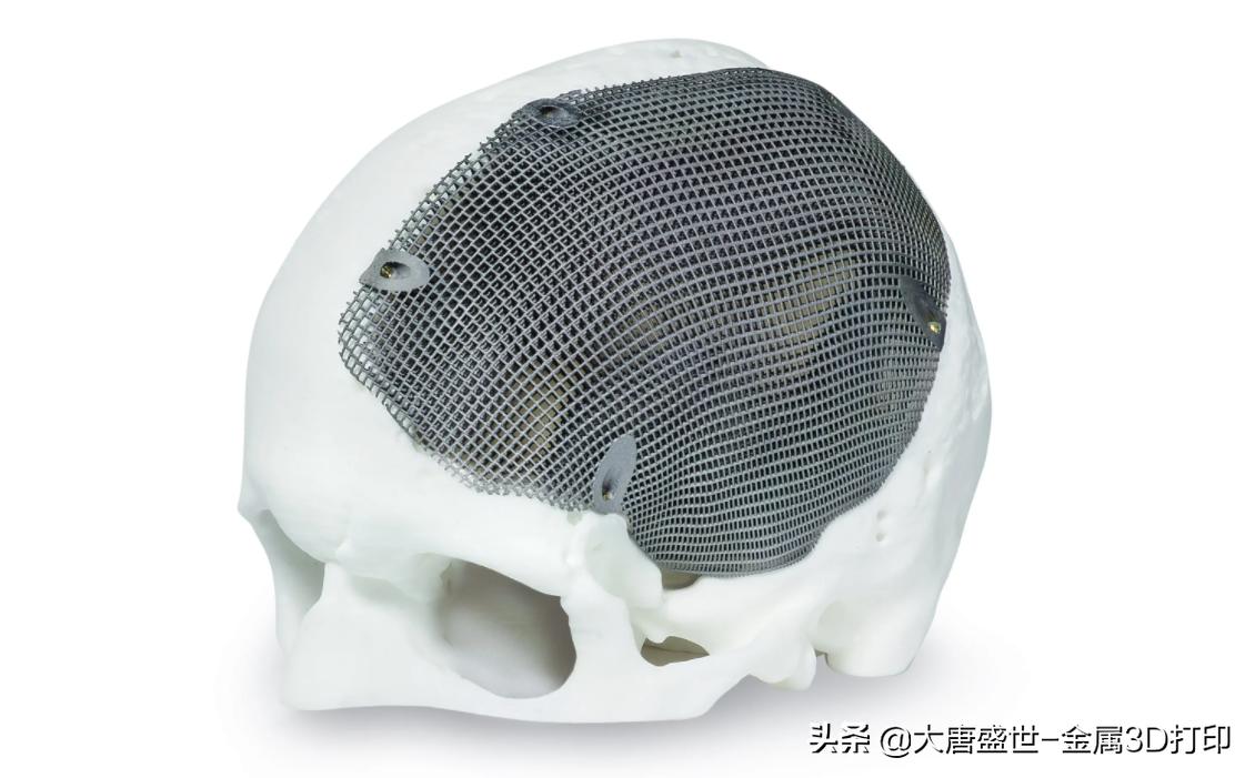 金属3d打印技术的应用有什么优势,科普金属3d打印技术为什么这么火